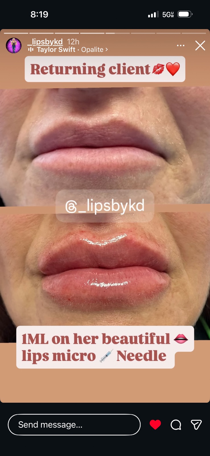 Show ready lips by @lipsbykd